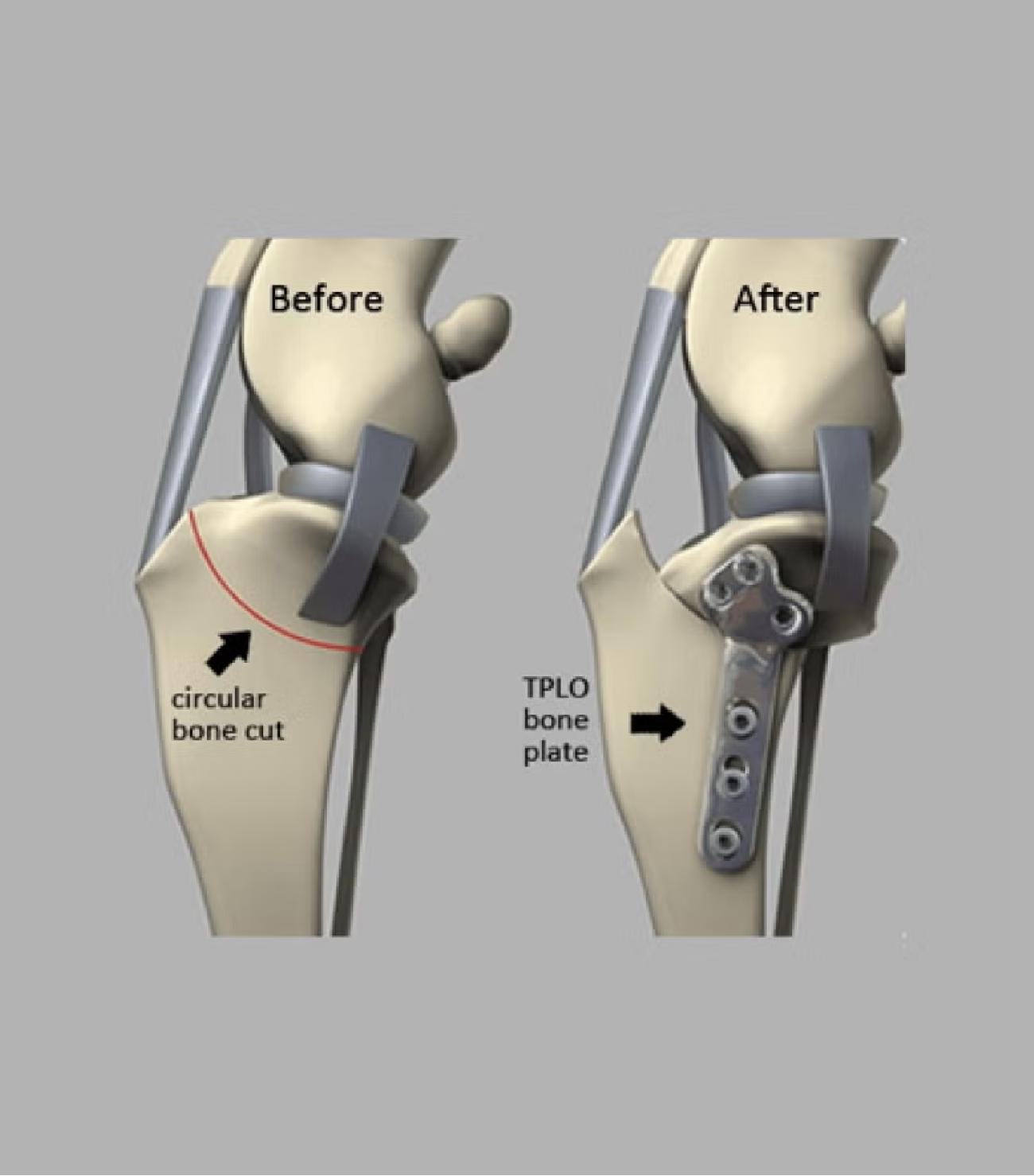 Tplo before after illustration
